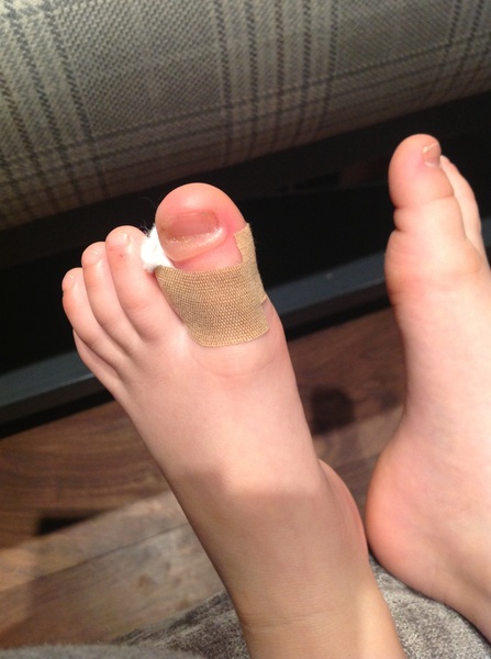Sarah’s disgusting toe (you have been warned)